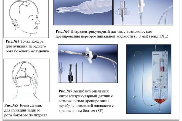 Почему не заходит на кракен